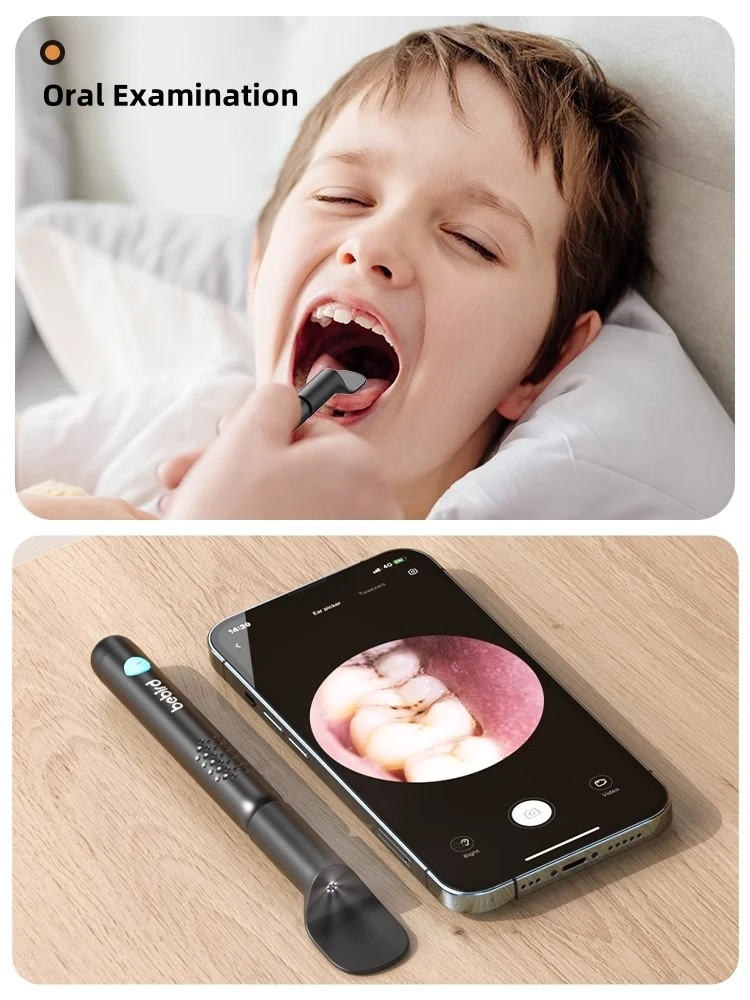 Bebird R3 Kulak Temizleyici Ak - Pet Ear Cleaner incelemesi ve fiyatı